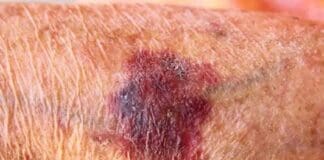 Coastal Skin Surgery 6641