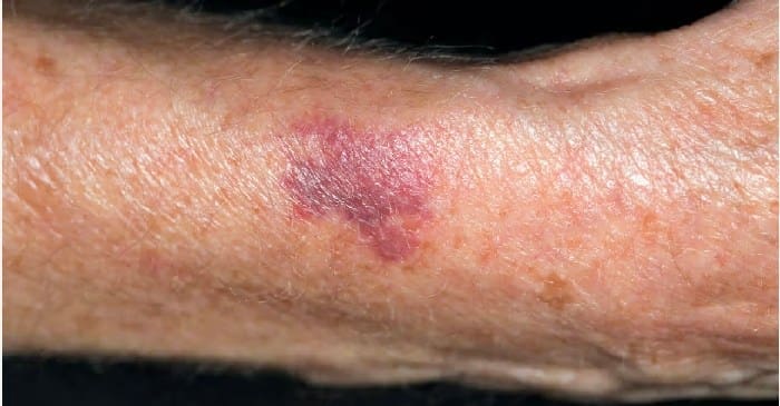 Coastal Skin Surgery 6642