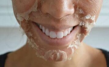 Consider a Chemical Peel Before Summertime Arrives Img 9133